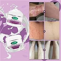 ScarCure Skin Smoothing Cream - Skin Rebound Scarless Cream - Cicatrix Healing Cream - Intensive Scar Removal Cream - Scarless Skin Rebound Cream - Desalination Acne Mark (2PCS)