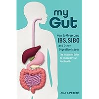 My Gut: How to overcome IBS, SIBO and other digestive issues My Gut: How to overcome IBS, SIBO and other digestive issues Paperback Kindle