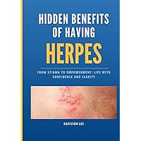 Hidden Benefits of having HERPES - Living with Herpes: From Stigma to Empowerment: Life with Confidence and Clarity - Herpes Book - Genital and Oral Herpes - HSV 1 and HSV 2