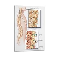 ZFASXZF Popular Science Poster on Prevention And Treatment of Cervical Spondylosis (4) Canvas Poster Bedroom Decor Office Room Decor Gift Frame-style 08 * 12in