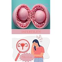 Infertility : Types,Causes, Symptoms, Diagnosis, Treatment and Prevention