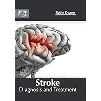Stroke: Diagnosis and Treatment