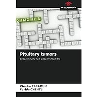 Pituitary tumors: Endocrine and non-endocrine tumors