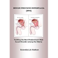 BENIGN PROSTATIC HYPERPLASIA: Tackling the Most Predominant Male Sexual Disorder among the Elderly BENIGN PROSTATIC HYPERPLASIA: Tackling the Most Predominant Male Sexual Disorder among the Elderly Kindle Paperback