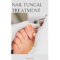 NAIL FUNGAL TREATMENT : The Scientific Guide to Nail Fungus Treatment NAIL FUNGAL TREATMENT : The Scientific Guide to Nail Fungus Treatment Kindle Paperback