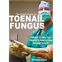 The Quick Guide to Toenail Fungus: What It Is, Why You Have It, & How to Free Yourself From It
