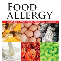 Food Allergy E-Book: Expert Consult Basic Food Allergy E-Book: Expert Consult Basic Kindle Hardcover