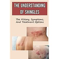 The Understanding Of Shingles: The History, Symptoms, And Treatment Options