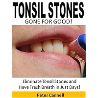 Tonsil Stones Gone for Good: Eliminate Tonsil Stones and Have Fresh Breath in Just Days!