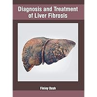 Diagnosis and Treatment of Liver Fibrosis