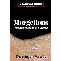 Morgellons: The legitimization of a disease: A Factual Guide by the World's Leading Clinical Expert Morgellons: The legitimization of a disease: A Factual Guide by the World's Leading Clinical Expert Paperback Kindle