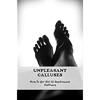 Unpleasant Calluses: How To Get Rid Of Unpleasant Calluses