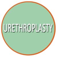 Urethroplasty stricture disease in men