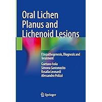 Oral Lichen Planus and Lichenoid Lesions: Etiopathogenesis, Diagnosis and Treatment Oral Lichen Planus and Lichenoid Lesions: Etiopathogenesis, Diagnosis and Treatment Kindle Hardcover