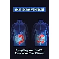 What Is Crohn's Disease?: Everything You Need To Know About Your Disease