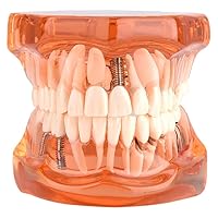 Orange Color Dental Disease Removable Demonstration Study Teaching Teeth Model for Dentist & School