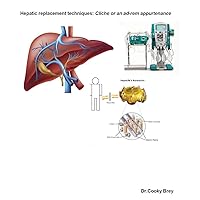 Hepatic replacement techniques: Cliche or an ad-rem appurtenance (Preliminary) Hepatic replacement techniques: Cliche or an ad-rem appurtenance (Preliminary) Kindle Paperback