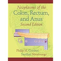 Neoplasms of the Colon, Rectum, and Anus Neoplasms of the Colon, Rectum, and Anus Hardcover Kindle