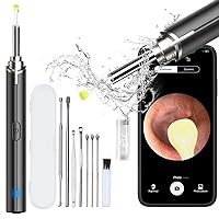 Visible Earwax Removal Tool with 1296P Otoscope, 3.5mm Slim Lens, Soft Gel Ear Spoon and Ear Cleaner kit, Compatible with iOS & Android (Black)