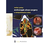 Endoscopic Sinus Surgery: A Comprehensive Atlas Endoscopic Sinus Surgery: A Comprehensive Atlas Kindle Hardcover Paperback Mass Market Paperback
