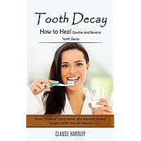 Tooth Decay: How to Heal Cavities and Reverse Tooth Decay (How I Stopped Tooth Decay and Avoided Dental Surgery With This All Natural)