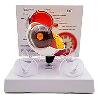 Eyeball Lesion Model, Removable Cataract Eye Model, Corneal Disease Model, Human Organ Anatomy Model, for Medical Teaching Display