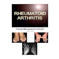 Curing Rheumatoid Arthritis