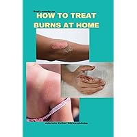 HOW TO TREAT BURNS AT HOME HOW TO TREAT BURNS AT HOME Kindle Paperback