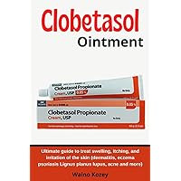 CLOBETASOL OINTMENT: Ultimate guide to treat swelling, itching, and irritation of the skin (dermatitis, eczema psoriasis Lignus planus lupus, acne and more)