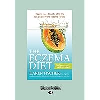The Eczema Diet Eczema-Safe Food To Stop: Eczema-Safe Food to Stop The Itch and Prevent Eczema for Life The Eczema Diet Eczema-Safe Food To Stop: Eczema-Safe Food to Stop The Itch and Prevent Eczema for Life Paperback
