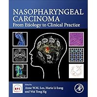Nasopharyngeal Carcinoma: From Etiology to Clinical Practice Nasopharyngeal Carcinoma: From Etiology to Clinical Practice Paperback Kindle