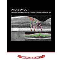 Atlas of OCT: Retinal Anatomy in Health & Pathology