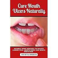 Cure Mouth Ulcers Naturally: Natural Home Remedies to Relieve Canker Pain, Mouth Sores and Mouth Irritation