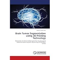 Brain Tumor Segmentation using 3D Printing Technology: Extraction of white matter tracts for neurosurgical treatment planning and 3D printing of the brain tumor