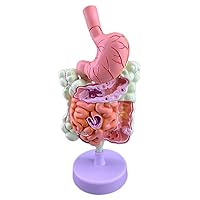 Human Large Intestine Pathological Anatomy Model, Showing Various Diseases of The Colon and Rectum, Standard Medical Teaching Display Model