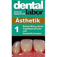 Behandlung eines Papillenverlusts mit Keramikveneers (das dental labor Fachtexte 13) (German Edition)