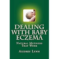 Dealing With Baby Eczema: Natural Methods That Work Dealing With Baby Eczema: Natural Methods That Work Paperback