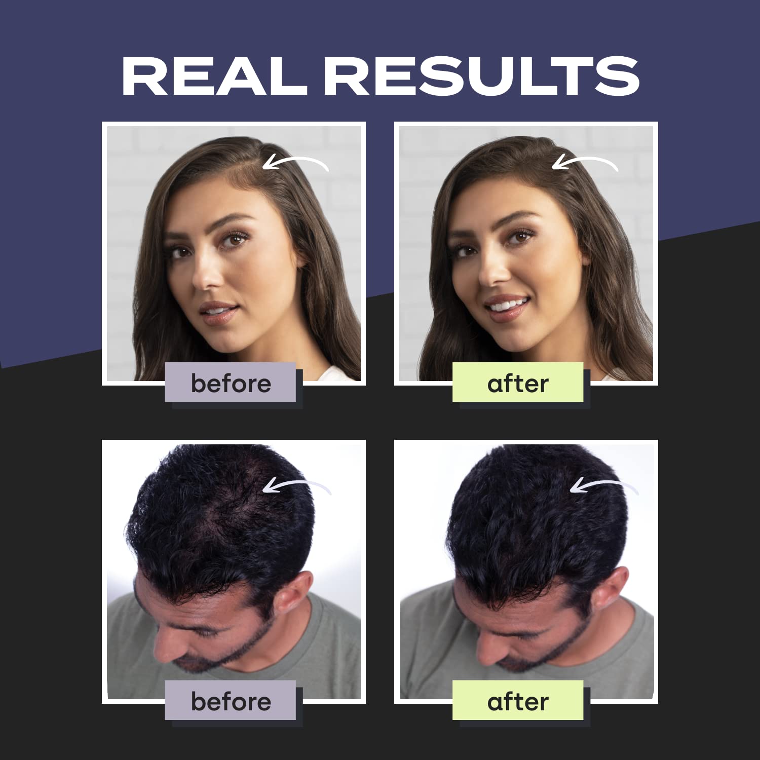 Mua Toppik Hair Building Fibers 12g | Fill In Fine or Thinning Hair |  Instantly Thicker, Fuller Looking Hair | 9 Shades for Men & Women trên  Amazon Mỹ chính hãng 2023 | Fado