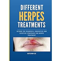 Different HERPES Treatments - Living With Herpes - For Those Recently Diagnosed: Beyond the Diagnosis: Innovative and Effective Strategies for Herpes ... Herpes - Oral Herpes - HSV 1 and HSV 2 Different HERPES Treatments - Living With Herpes - For Those Recently Diagnosed: Beyond the Diagnosis: Innovative and Effective Strategies for Herpes ... Herpes - Oral Herpes - HSV 1 and HSV 2 Paperback