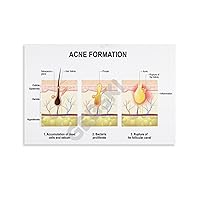 KMJBFE Beauty Salon Poster Acne Formation Type Poster Epidermal Structure Poster Canvas Painting Posters And Prints Wall Art Pictures for Living Room Bedroom Decor 12x18inch(30x45cm) Unframe-style