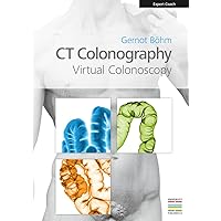 CT-Colonography Virtual Colonoscopy CT-Colonography Virtual Colonoscopy Kindle