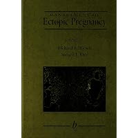 Management of Ectopic Pregnancy Management of Ectopic Pregnancy Hardcover