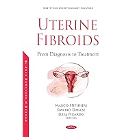 Uterine Fibroids from Diagnosis to Treatment