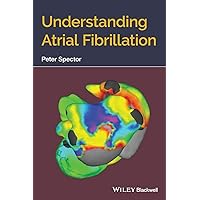 Understanding Atrial Fibrillation Understanding Atrial Fibrillation Paperback Kindle