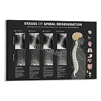 WENHUIMM Levels of Spinal Degeneration Chiropractors Spine Knowledge Guide Poster (5) Home Living Room Bedroom Decoration Gift Printing Art Poster Frame-style 36x24inch(90x60cm)
