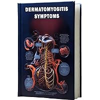 Dermatomyositis Symptoms: Explore the symptoms of dermatomyositis, an inflammatory muscle and skin disorder that can cause muscle weakness and skin rashes. Dermatomyositis Symptoms: Explore the symptoms of dermatomyositis, an inflammatory muscle and skin disorder that can cause muscle weakness and skin rashes. Paperback