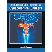 Identification and Treatment of Gynecological Cancers