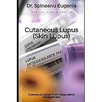 Cutaneous Lupus: From Diagnosis to Management