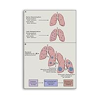 TSFTEC Smoking Addiction Lung Cancer Poster Poster for Lung Health Guidelines Canvas Painting Posters And Prints Wall Art Pictures for Living Room Bedroom Decor 08x12inch(20x30cm) Unframe-style