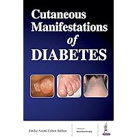 Cutaneous Manifestations of Diabetes Cutaneous Manifestations of Diabetes Kindle Paperback